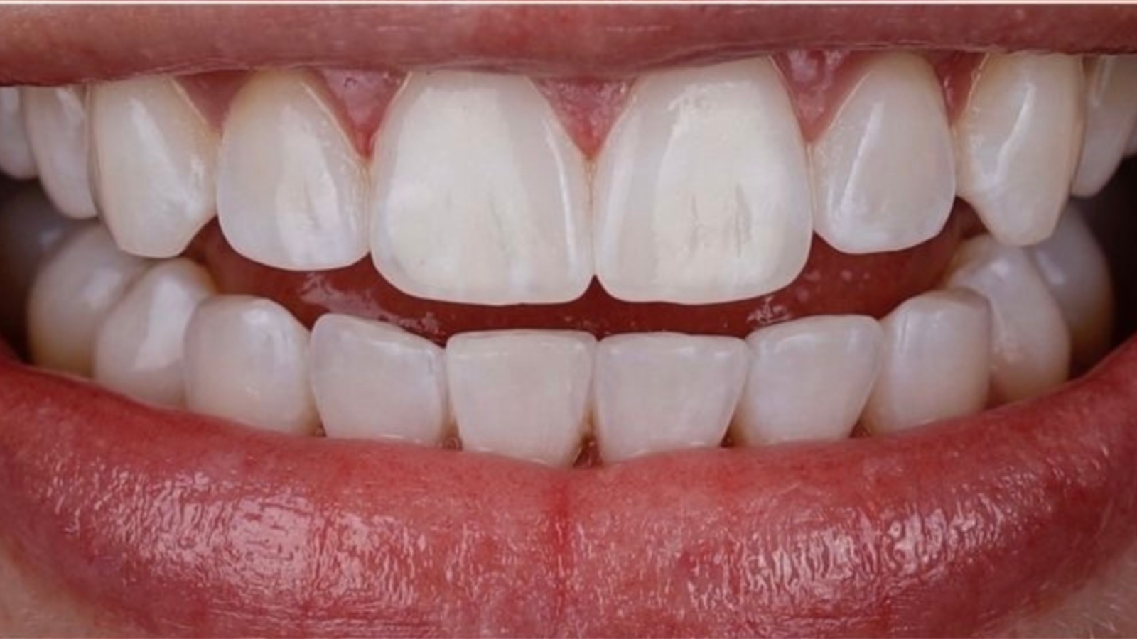 WhatsApp-Image-2025-06-11-at-10.10